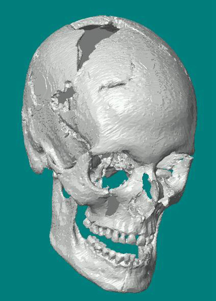 Her virtual skull after CT-scanning.