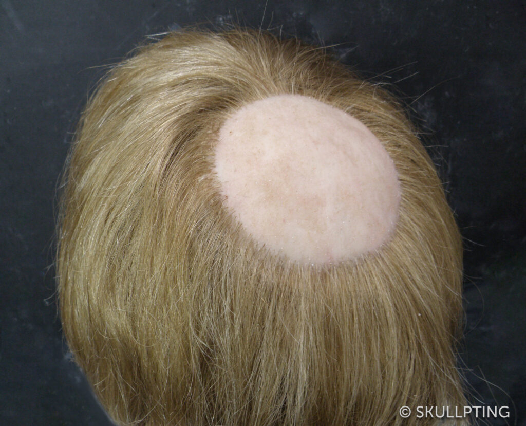 [en:]He had a little tonsure [nl:]Hij had een kleine tonsuur[:]