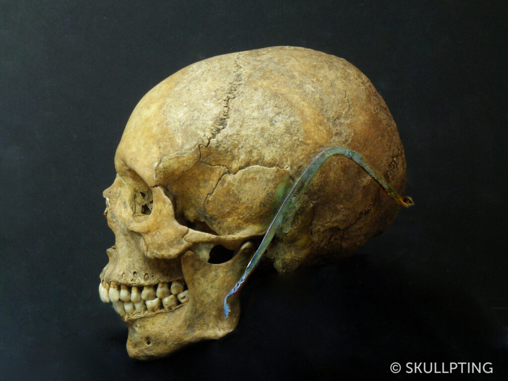 Skull with cap broach.